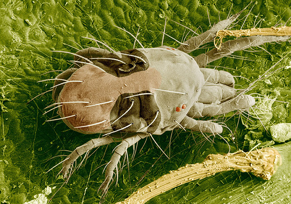 spider mite electron micrograph